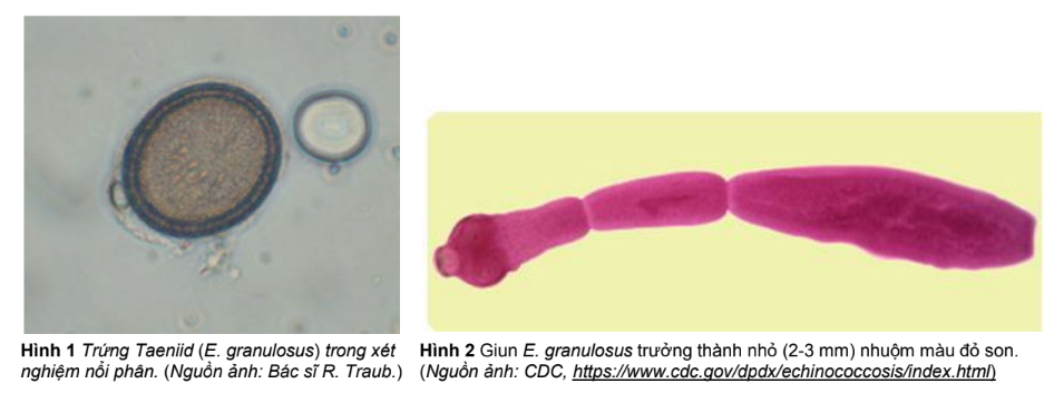 Hydatid Tapeworms